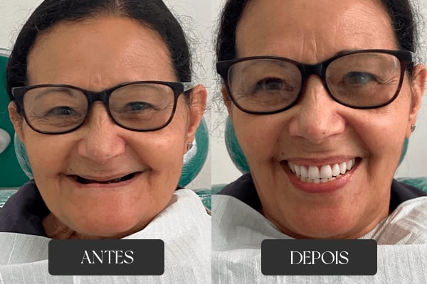 Antes e depois de tratamento odontológico